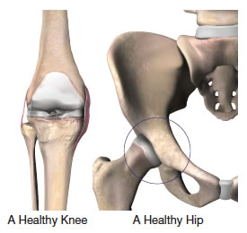 Joint Pain